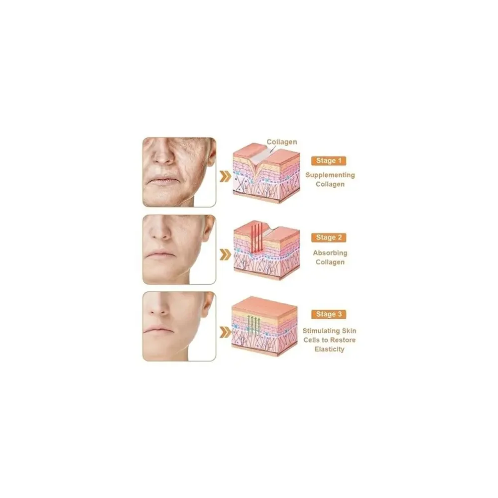 Bee Venom Skin Restoration Cream, Professional Bee Venom Skin Treatment Cream
